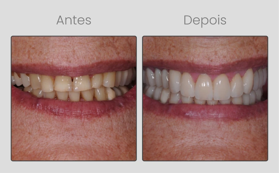 ANTESEDEPOIS-8.webp